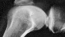 Knie bearbeitet I